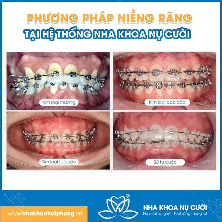 phuong-phap