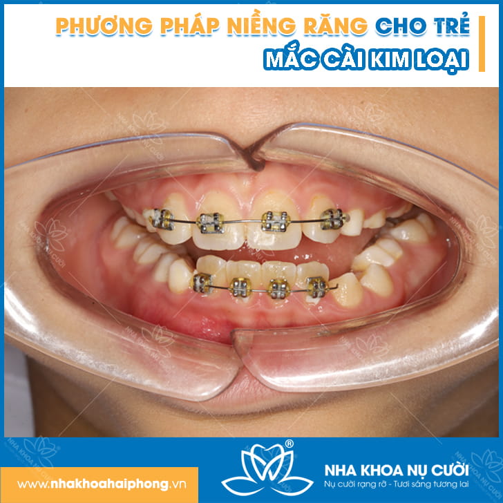 phuong-phap