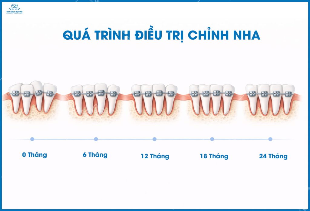 thoi-gian-nieng-rang