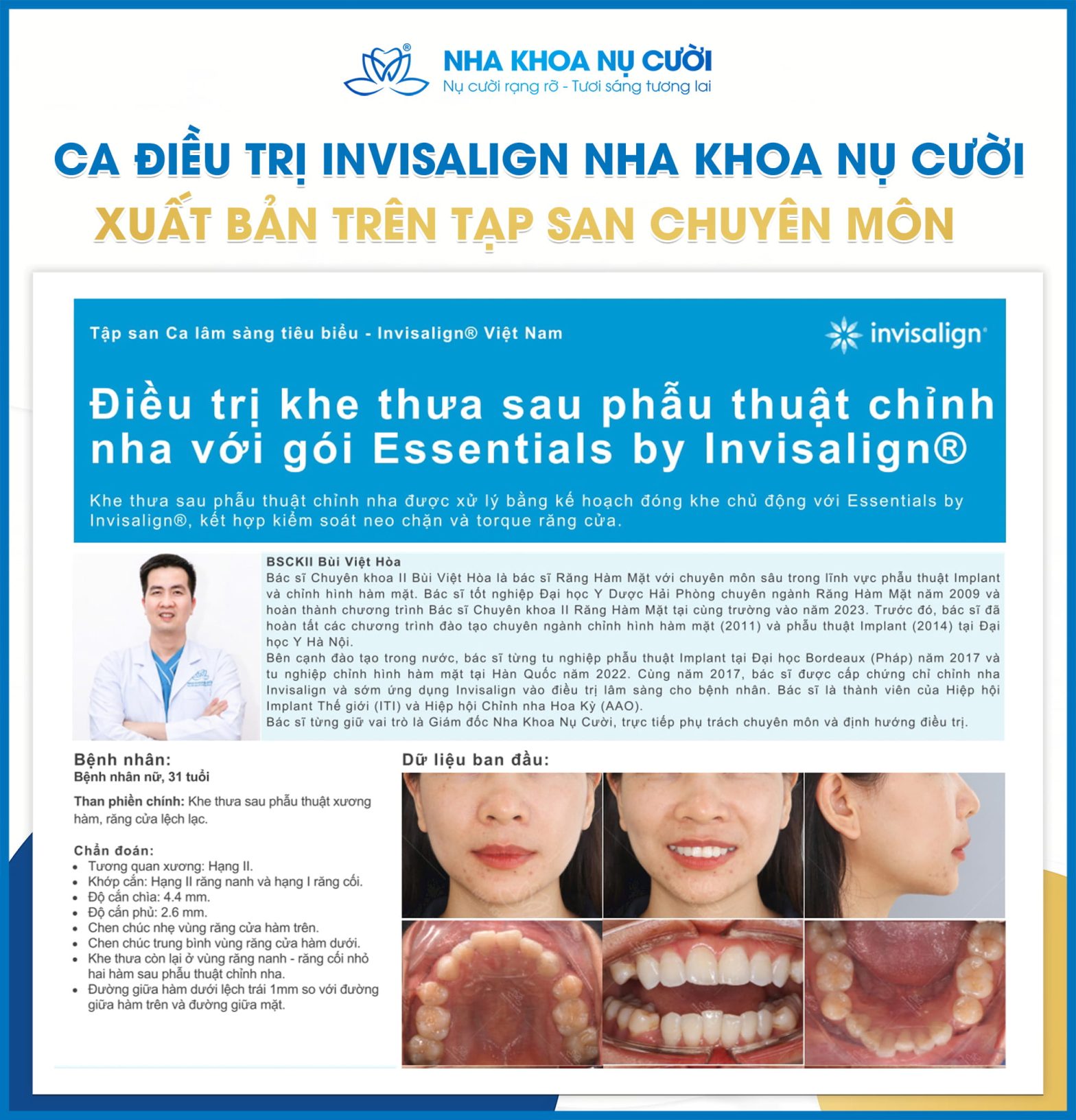 Ca Điều Trị Invisalign Xuất Bản Trên Tạp San Chuyên Môn