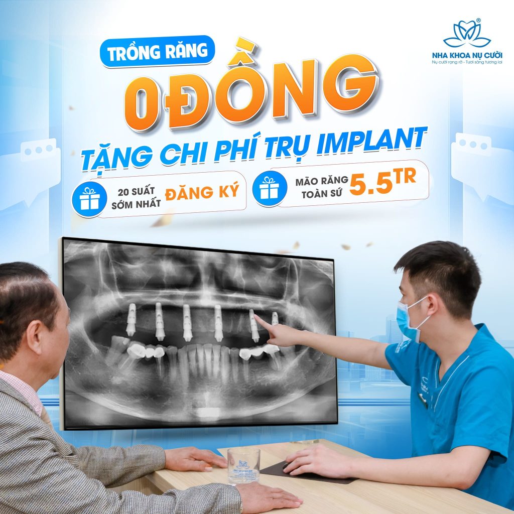 implant