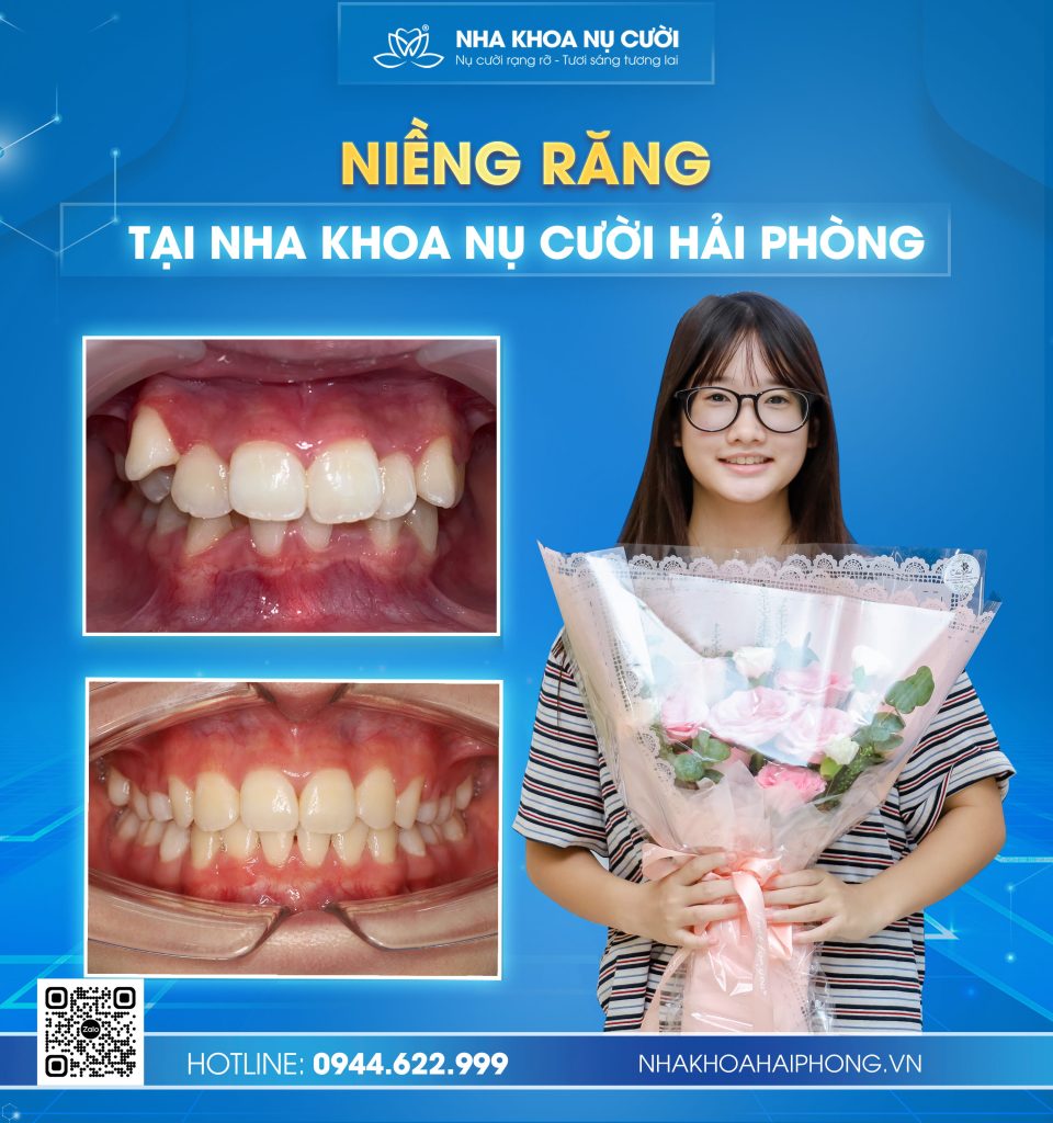 chinh-nha-tai-hai-phong