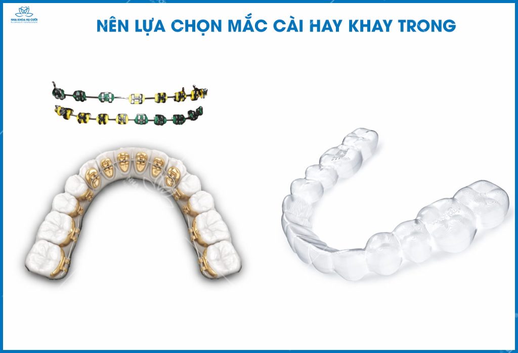 LUA-CHON