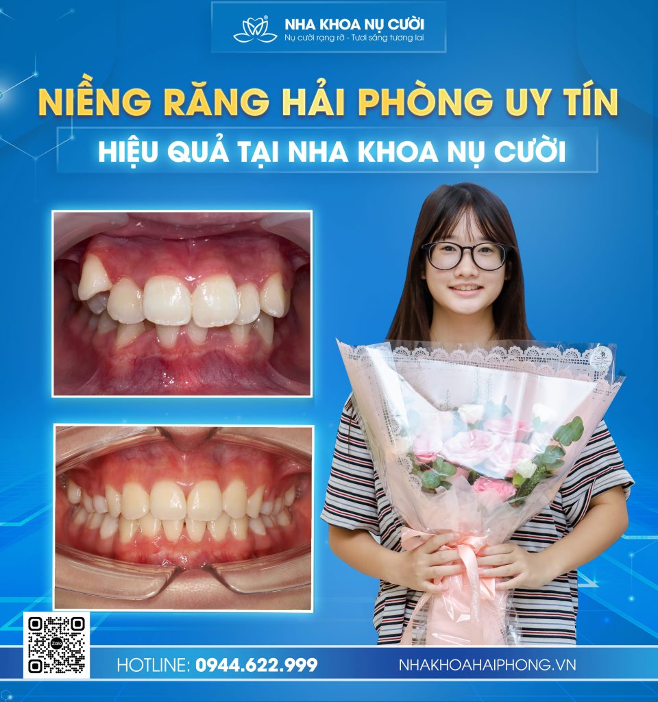 NIENG-rang-hai-phong-uy-tin