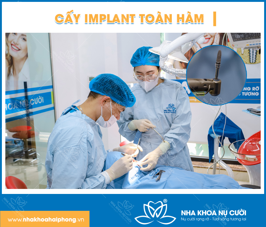 implant