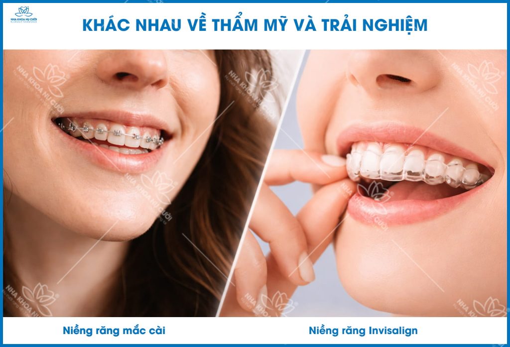 SO-SANH-THAM-MY