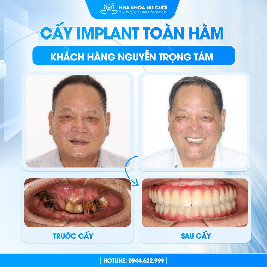 chu-trong-tam