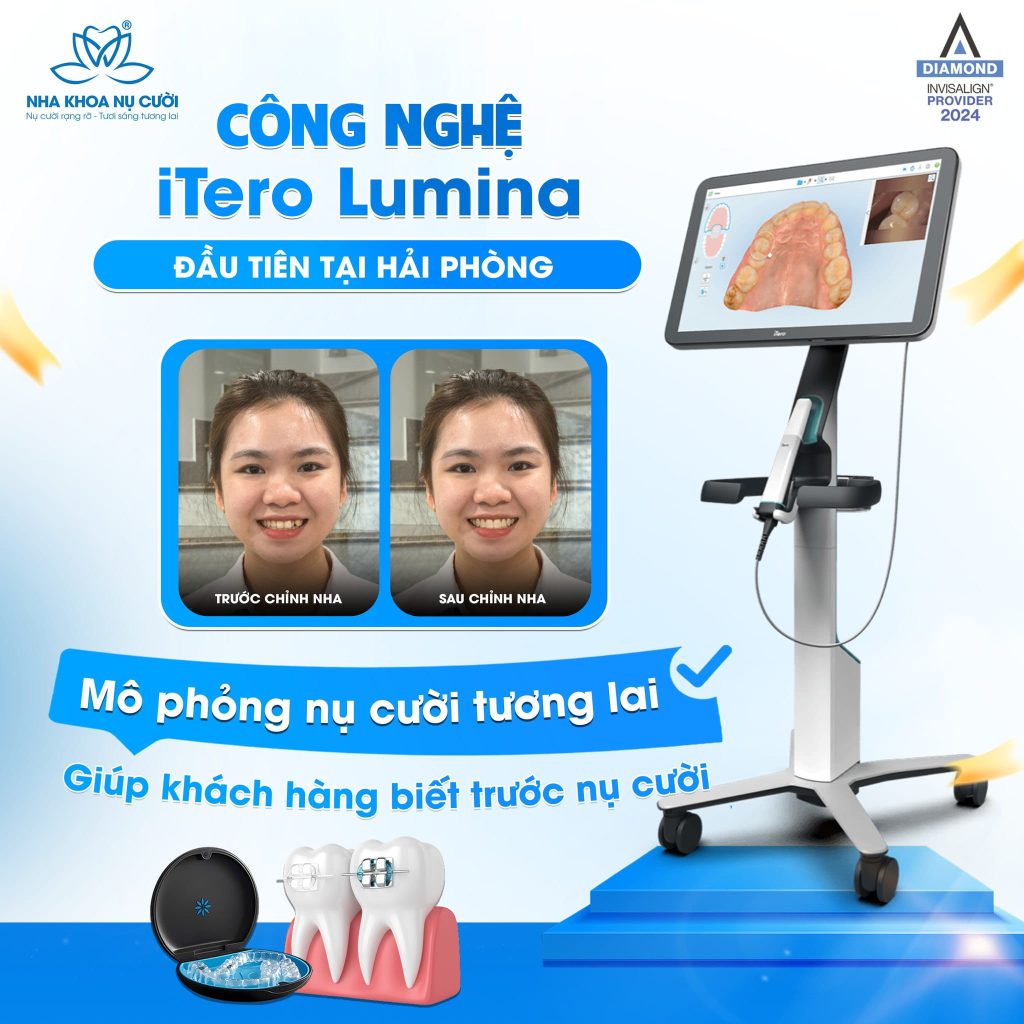 iTero-Lumina