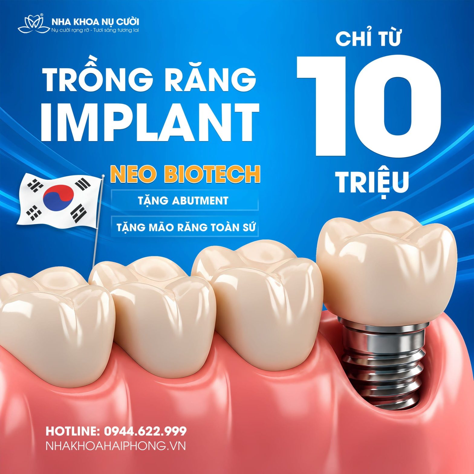 Ưu đãi trồng răng Implant chào hè tại Nha Khoa Nụ Cười