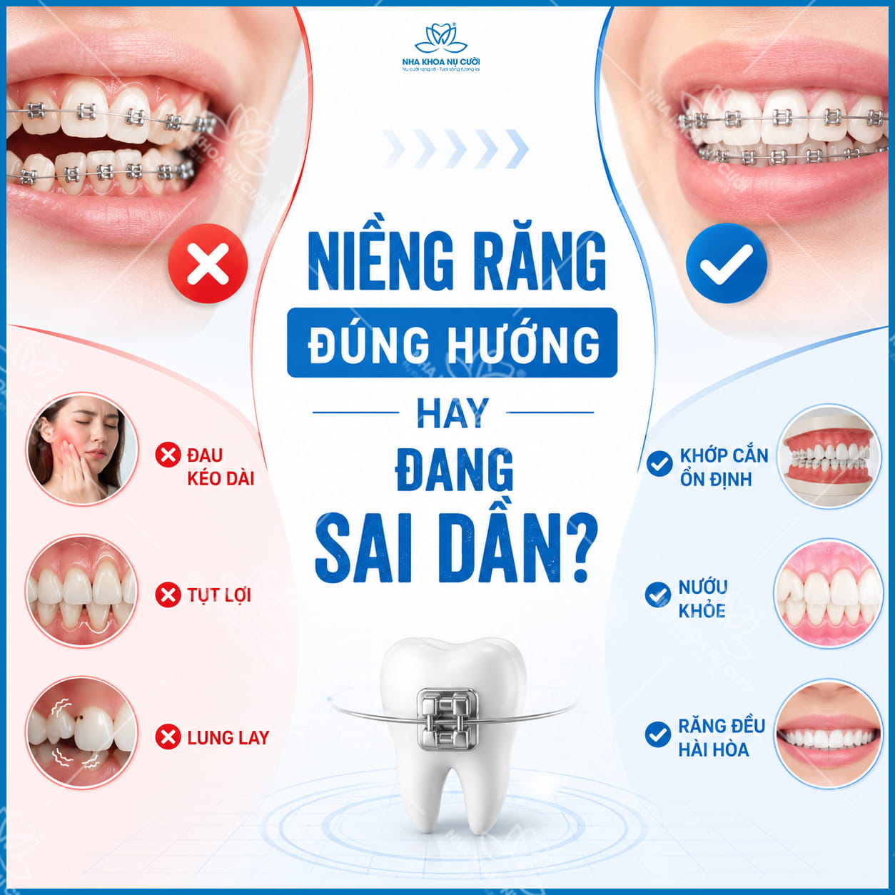 Dấu hiệu niềng răng sai hướng: Nhận biết sớm để tránh biến chứng