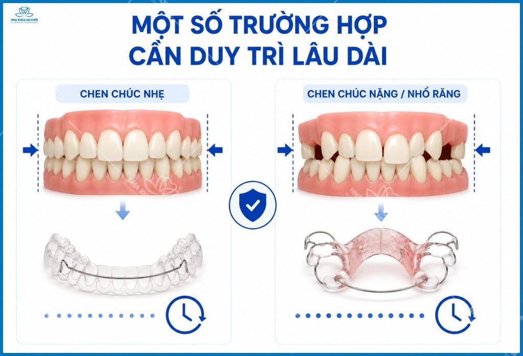 chinh-nha