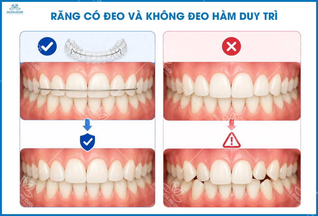 chinh-nha