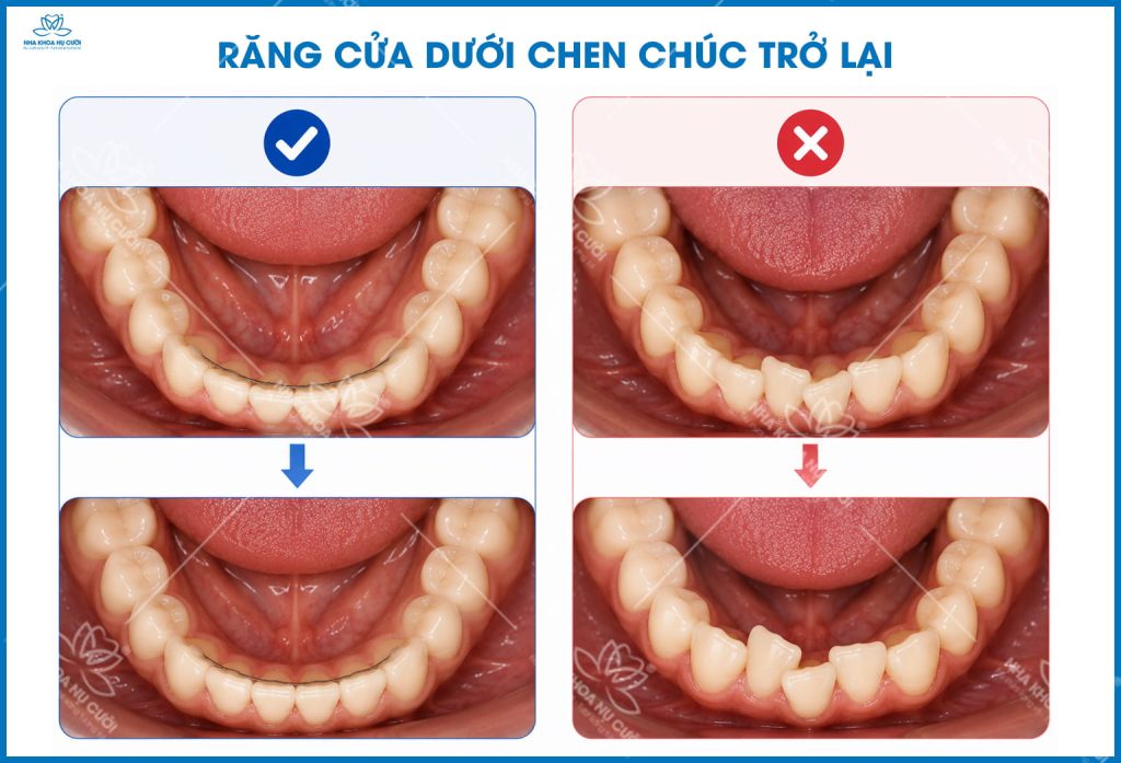 chinh-nha