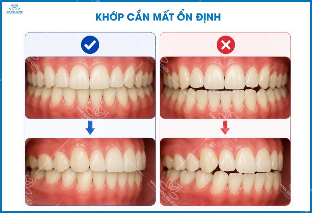 chinh-nha