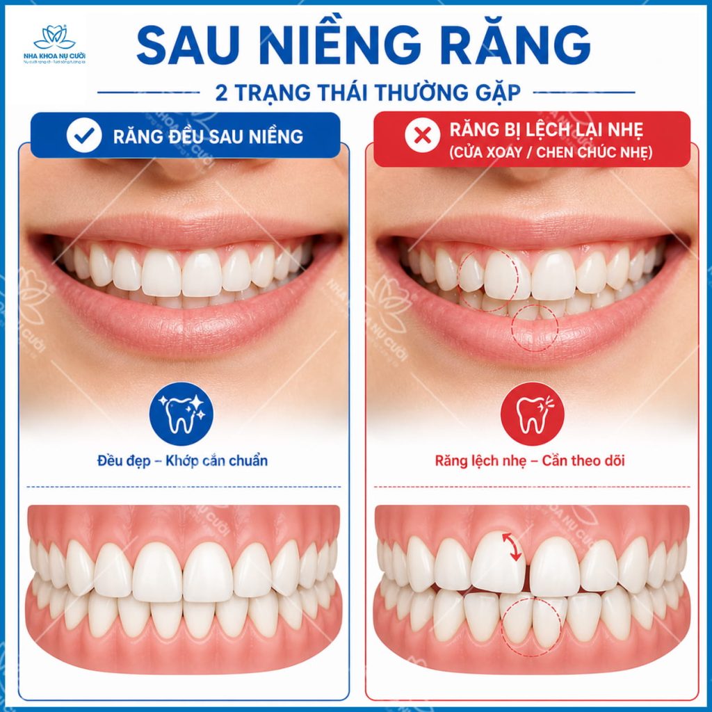 nieng-rang-xong-bi-chay-lai