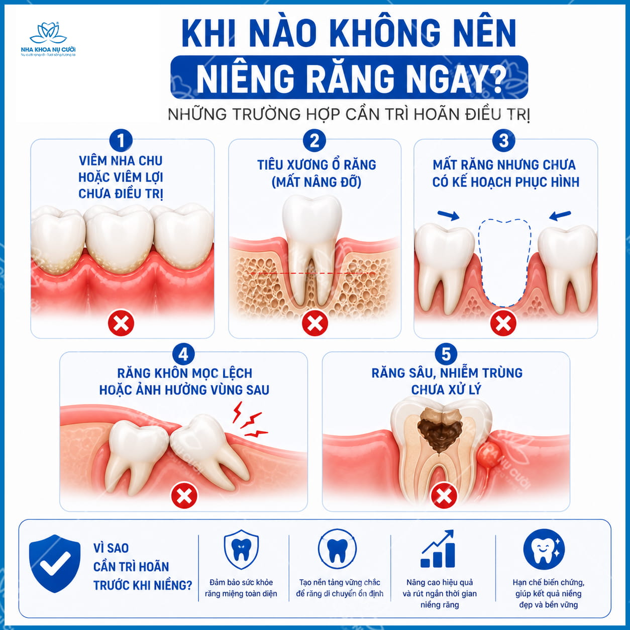 Khi nào không nên niềng răng ngay? Những trường hợp cần trì hoãn điều trị