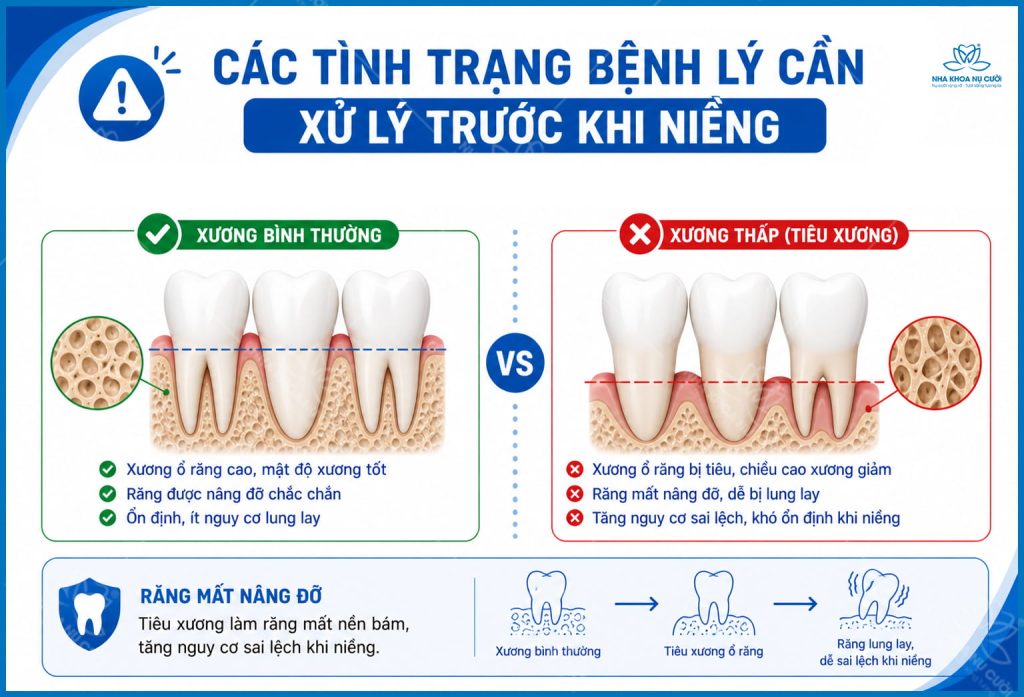 tieu-xuong-o-rang