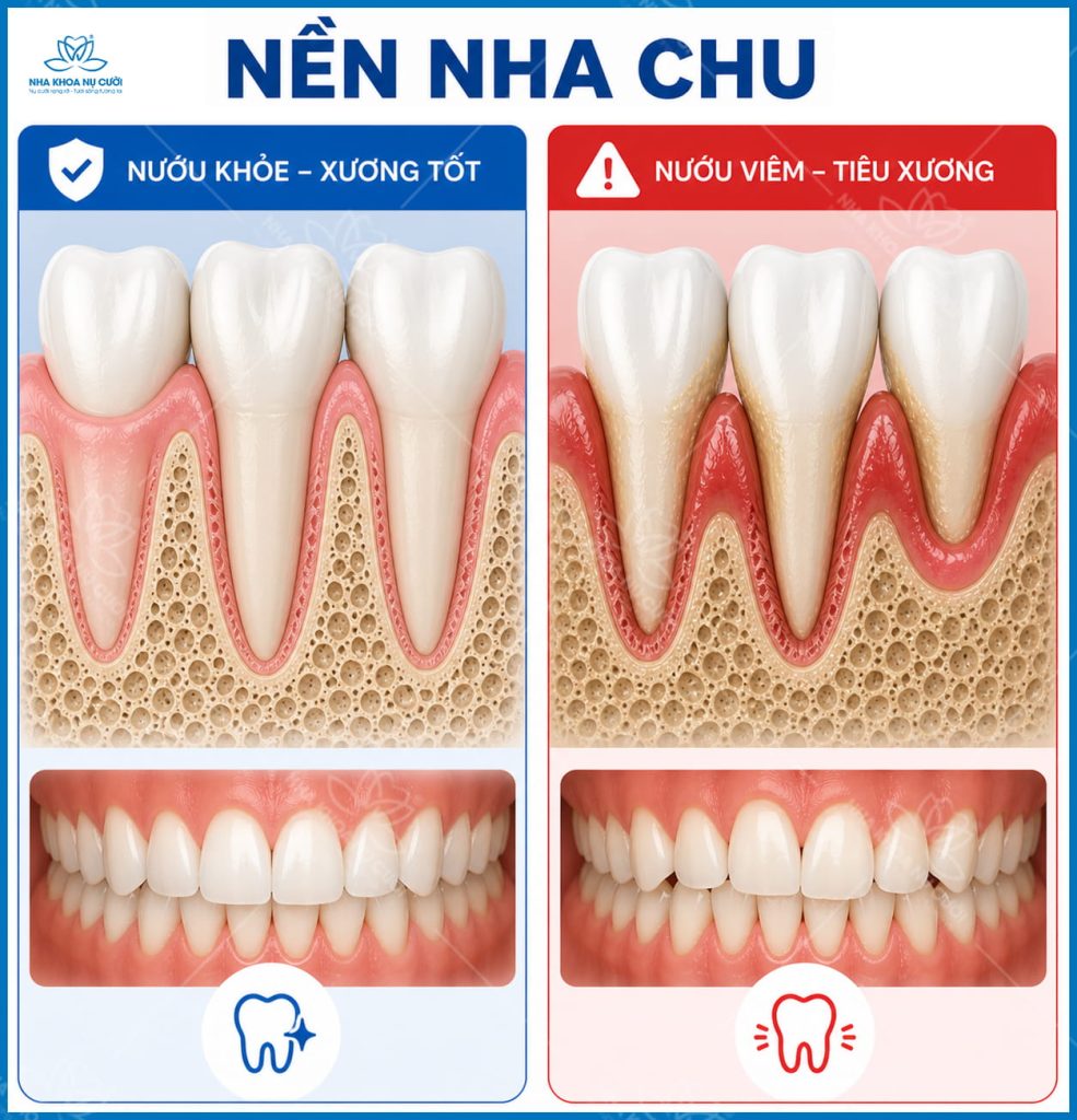 nieng-rang