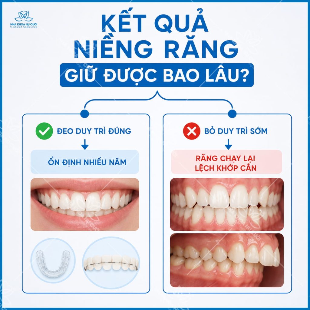 ket-qua-nieng-rang-giu-duoc-bao-lau.