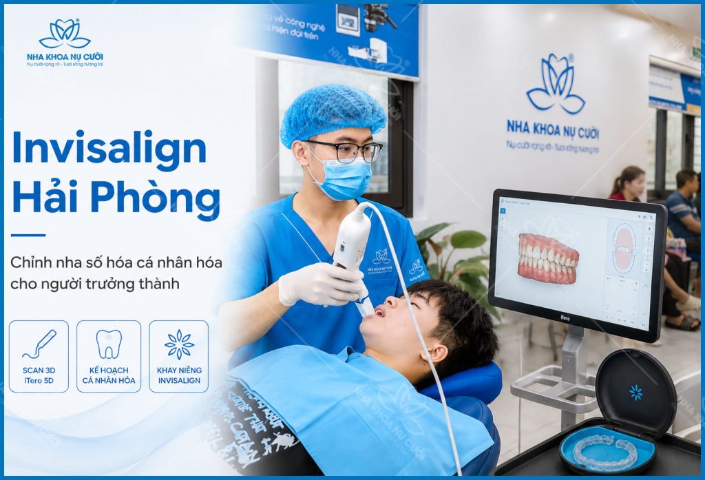 invisalign-hai-phong