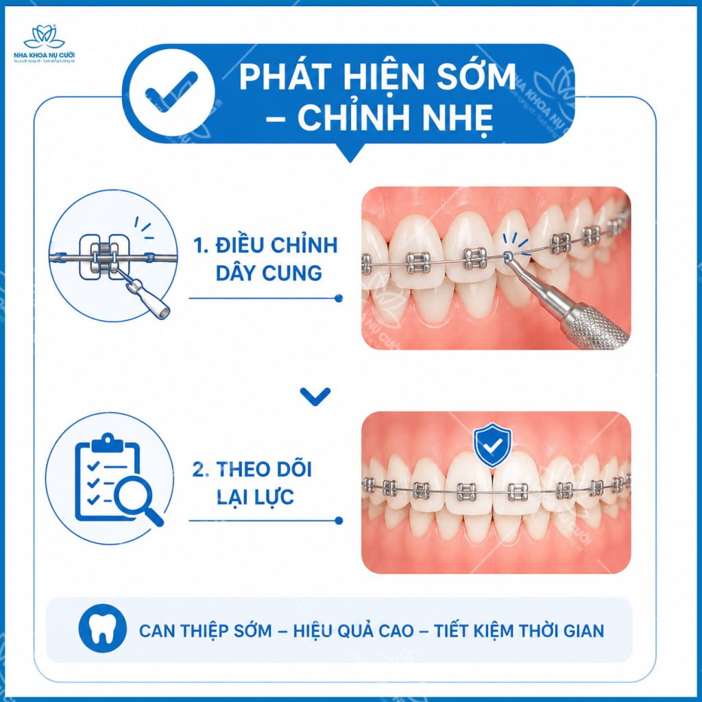 chinh-nhe