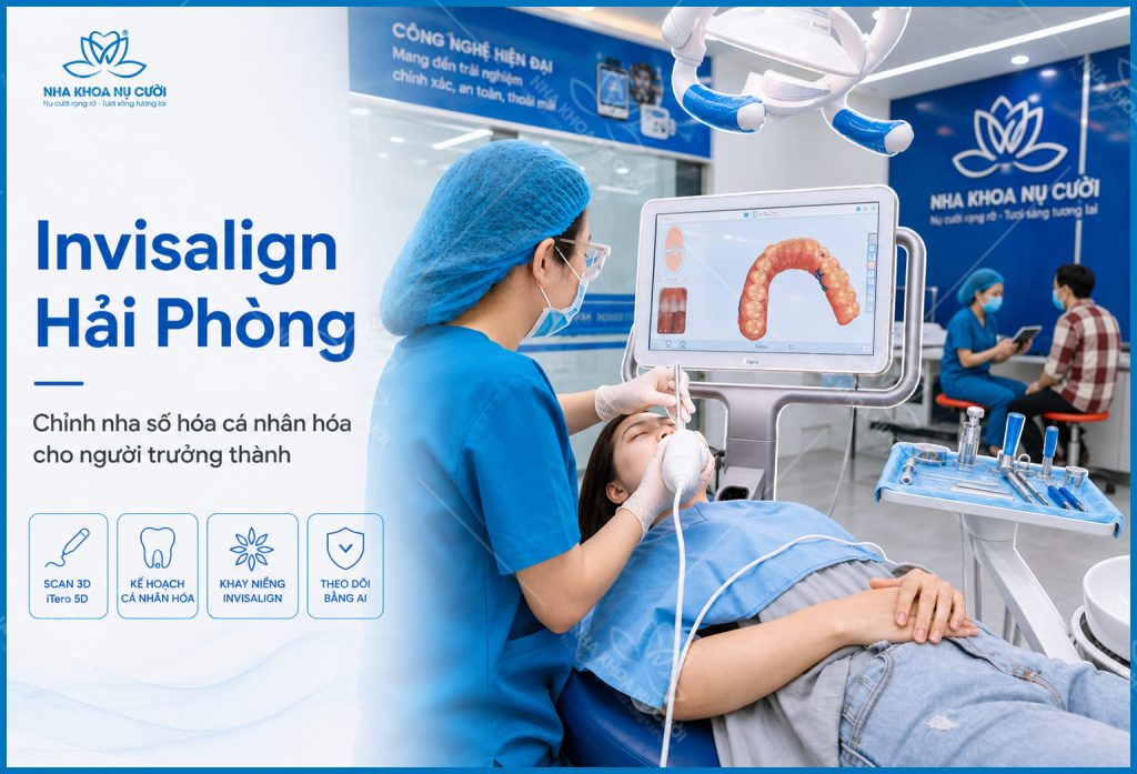 invisalign-hai-phong