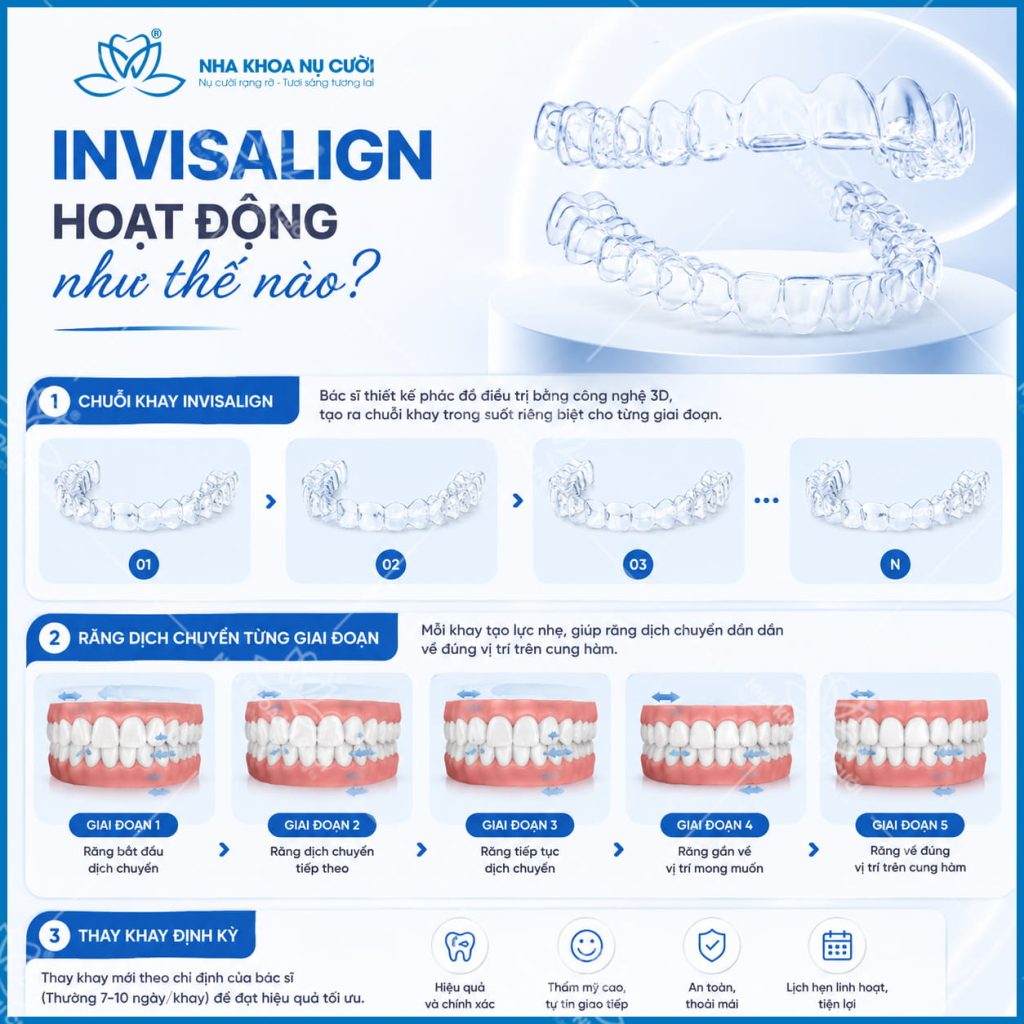 yeu-to-anh-huong-hieu-qua-invisalign
