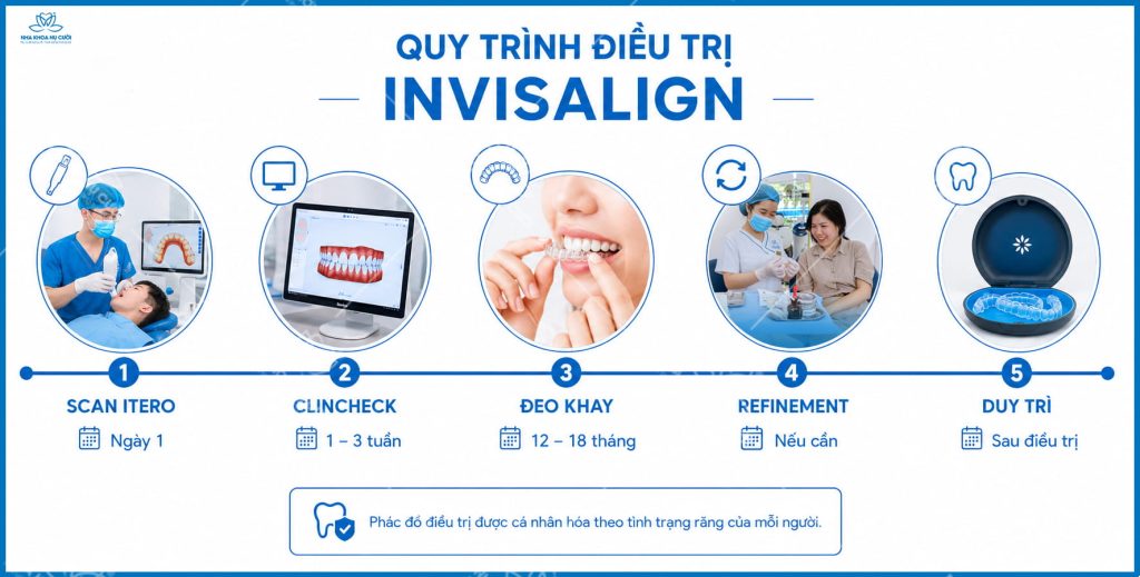 thoi-gian-dieu-tri-invisalign