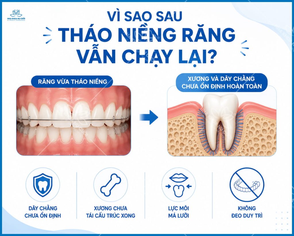 vi-sao