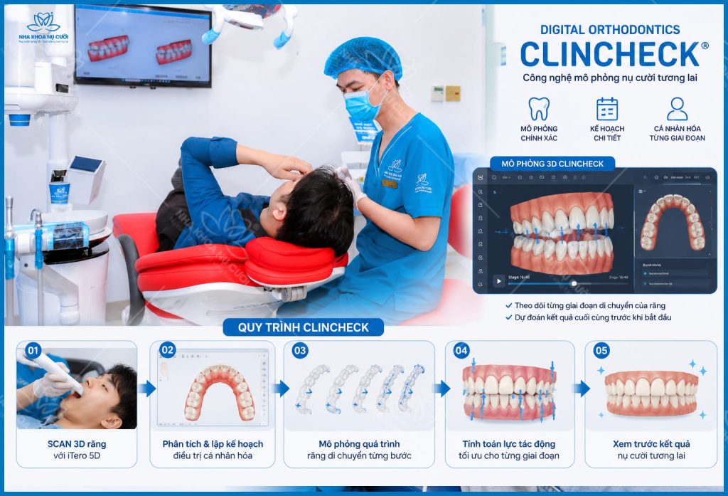 clincheck