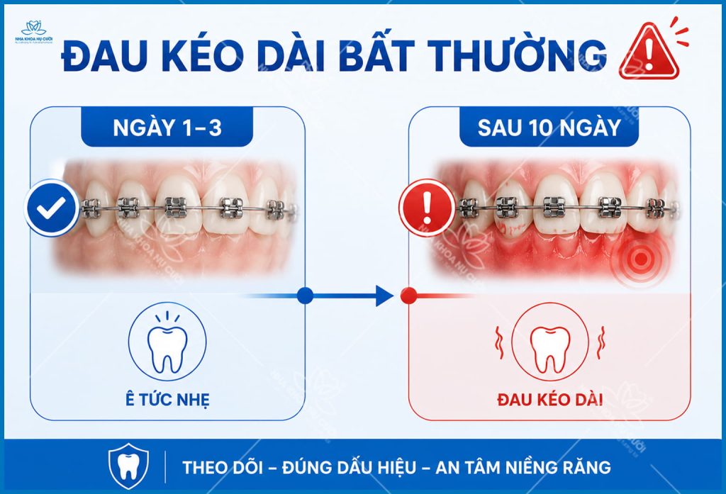 dau-hieu-nieng-rang-sai-huong