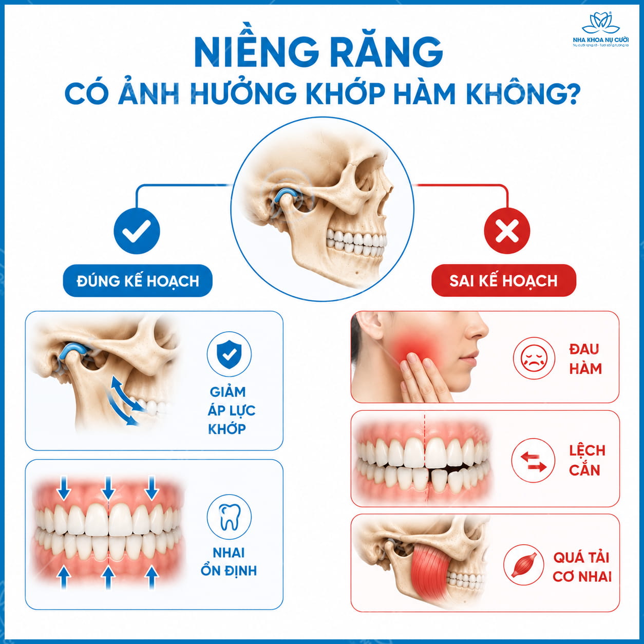 Niềng răng có ảnh hưởng khớp thái dương hàm không?