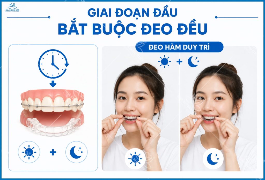 giai-doan-deo-ham-duy-tri