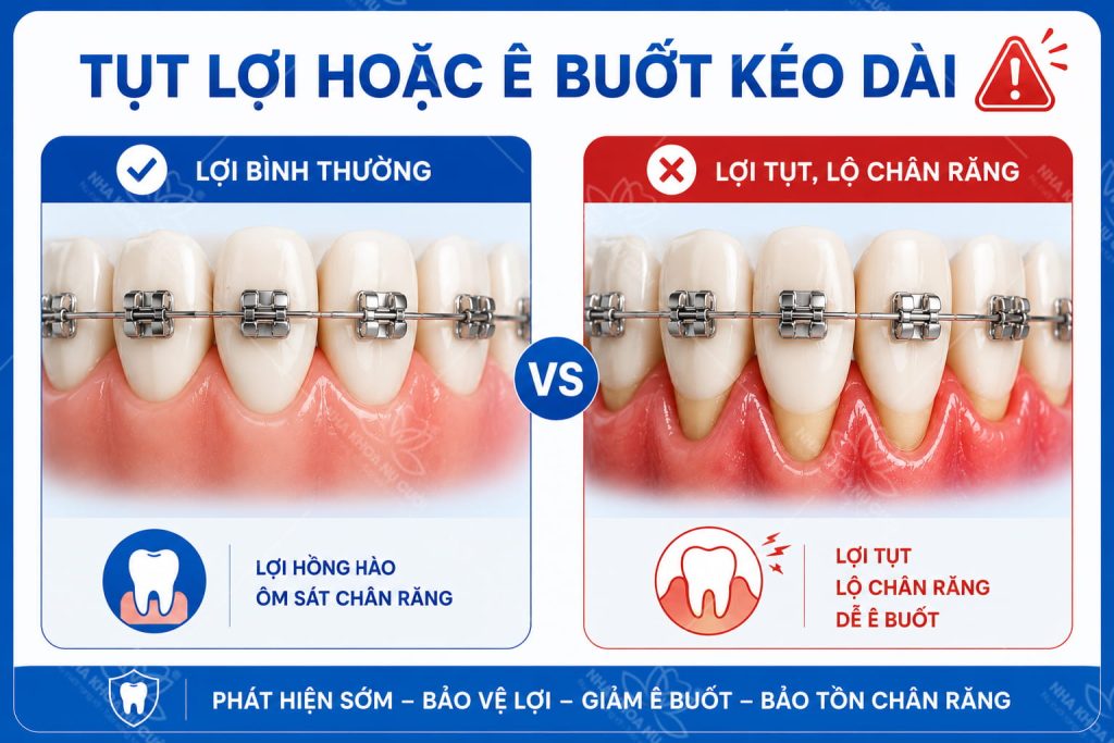 dau-hieu-nieng-rang-sai-huong