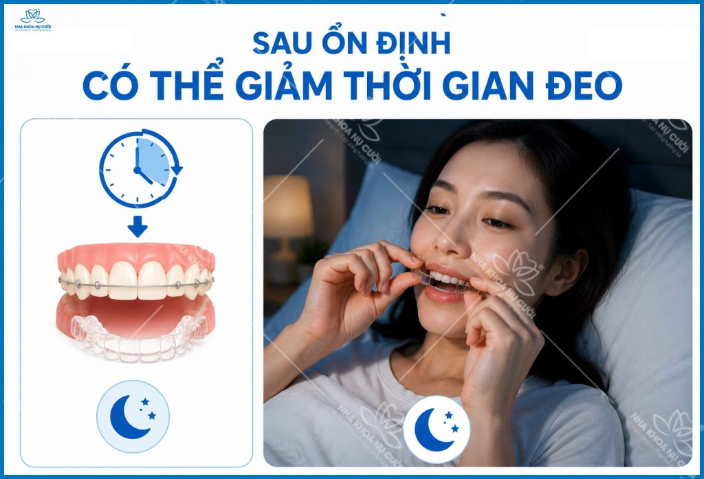 giai-doan-deo-ham-duy-tri