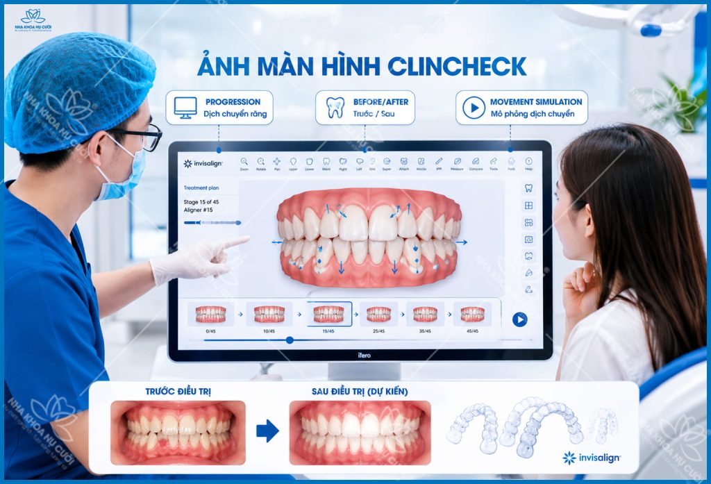 invisalign