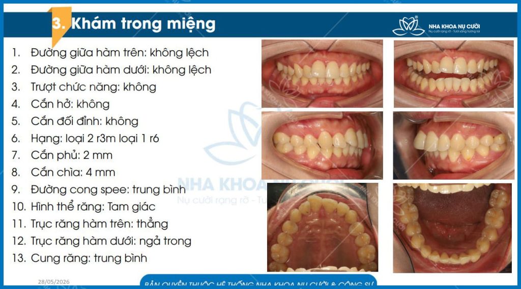 khach-hang-invisalign
