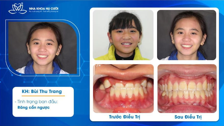 khach-hang-nieng-rang-hai-phong