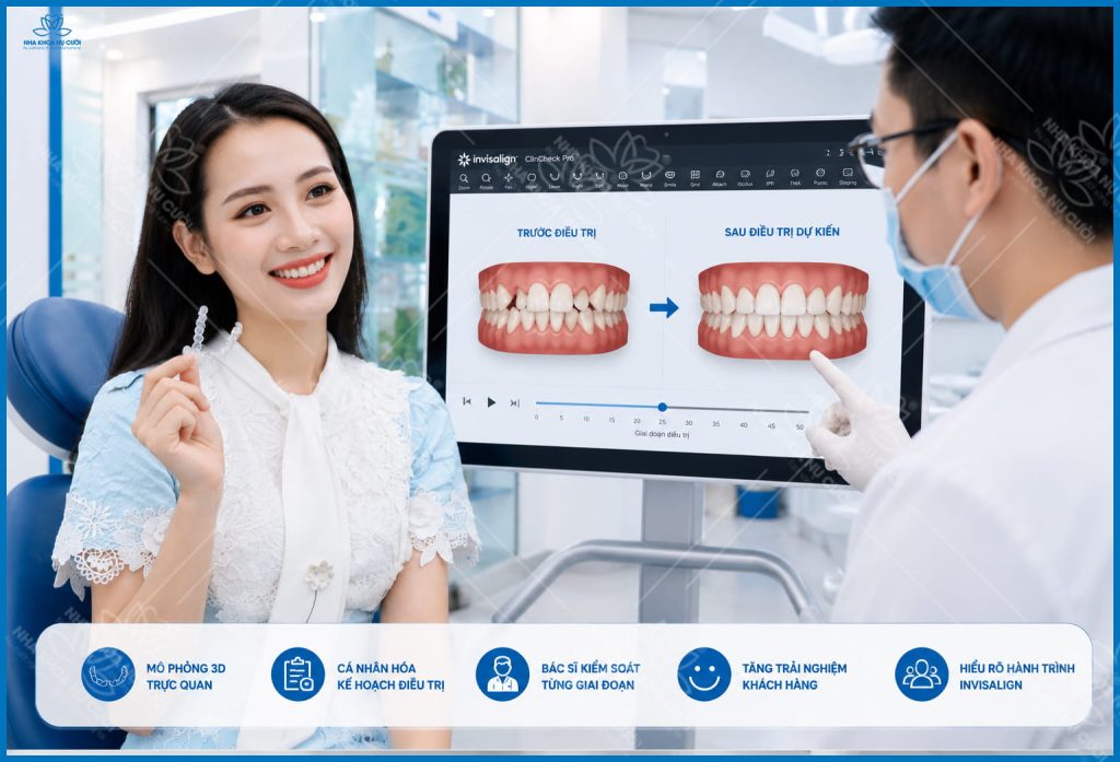 invisalign-thay-doi-khuon-mat-hai-phong