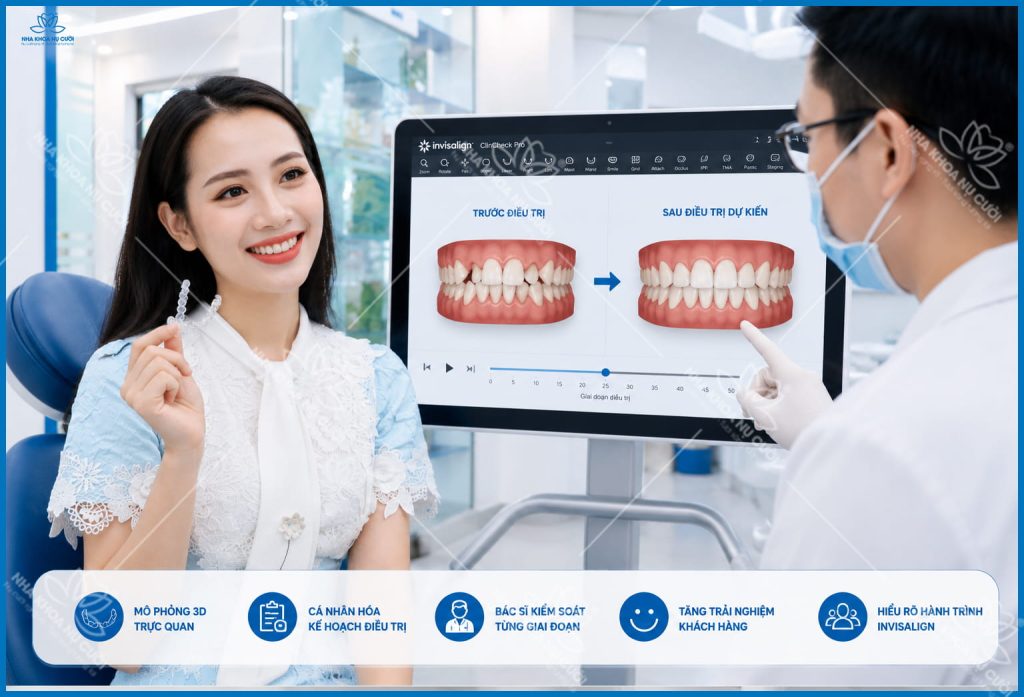 invisalign-thay-doi-khuon-mat-hai-phong