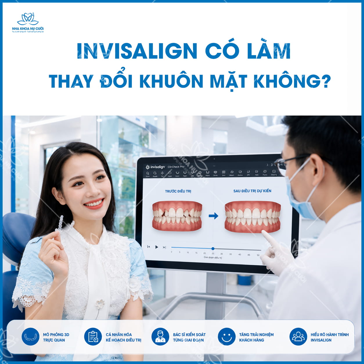 Invisalign có làm thay đổi khuôn mặt không? Góc nhìn từ chỉnh nha hiện đại