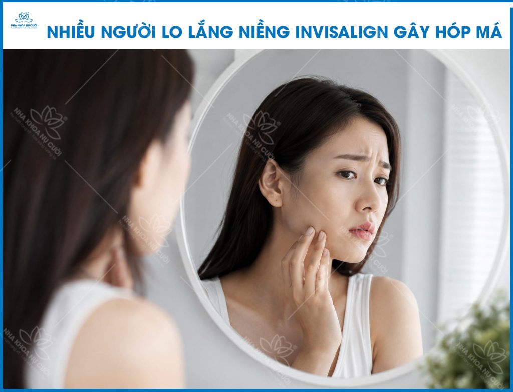 invisalign-hop-ma-hai-phong.