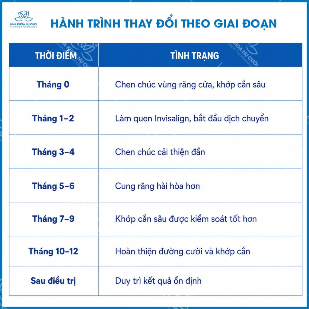 hanhtrinh-invisalign-theo-giai-doan