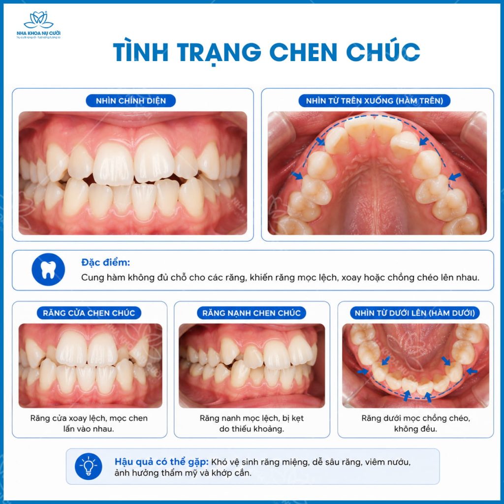 CHEN-CHUC