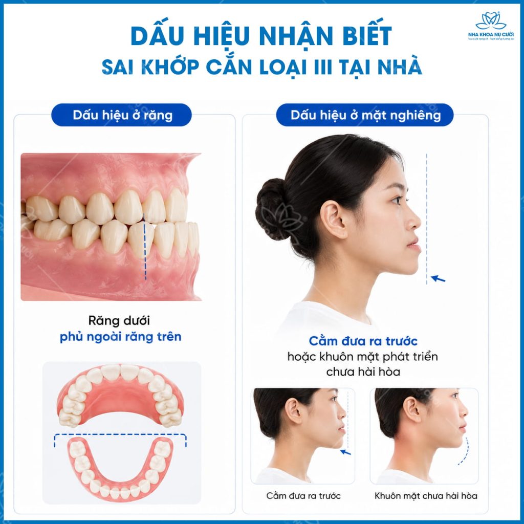 dau-hieu-sai-khop-can-loai-III-tai-nha