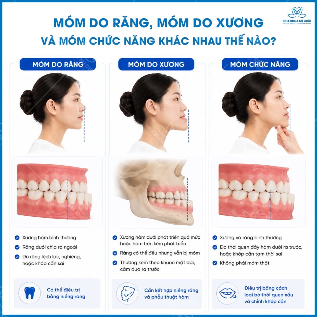 phan-biet-mom