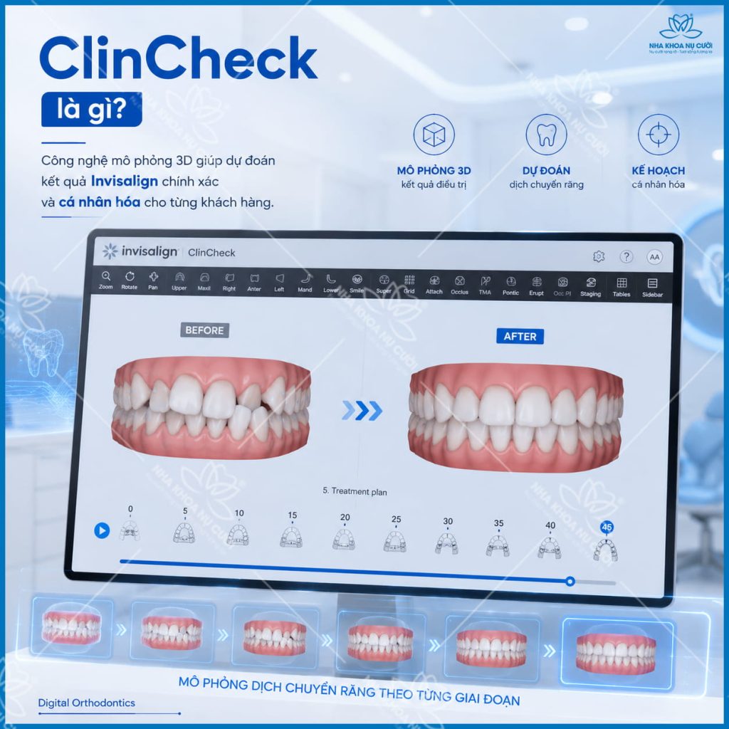 ClinCheck