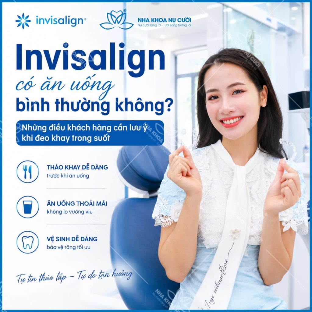 invisalign-co-an-uong-binh-thuong-hai-phong