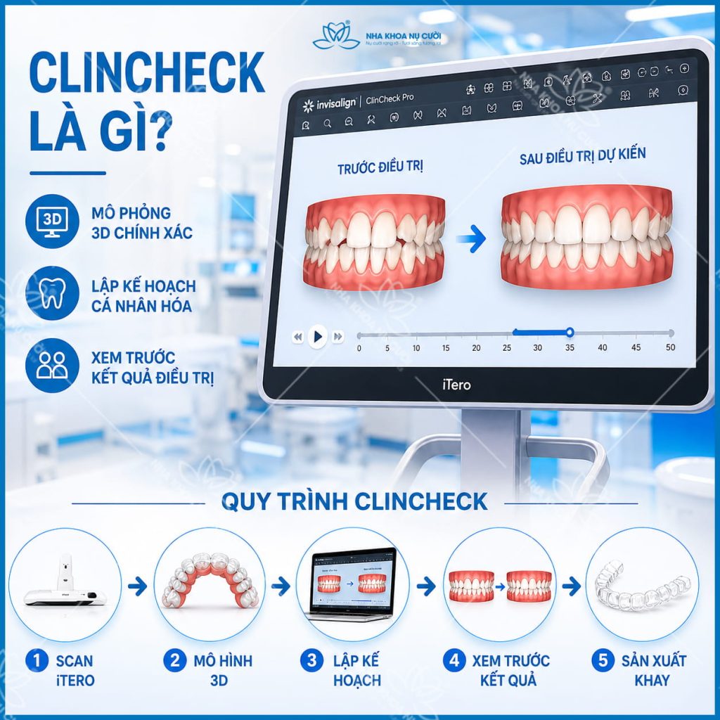 mo-phong-ClinCheck