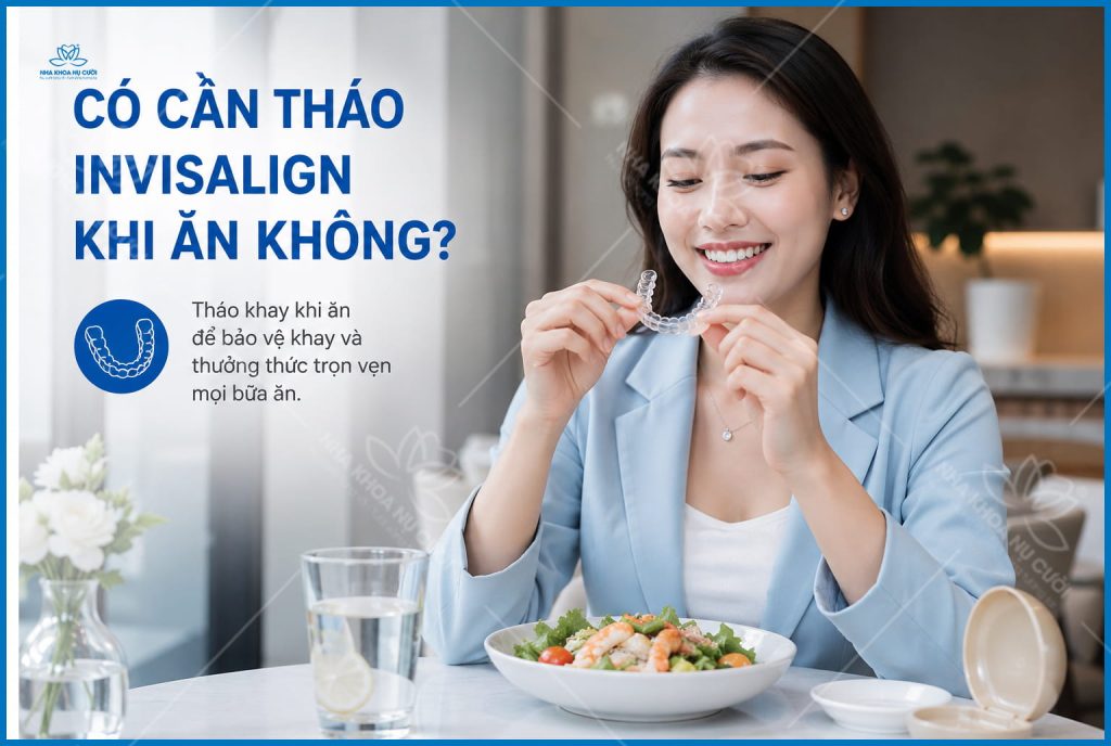 invisalign-an-uong-hai-phong